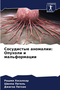 Сосудистые аномалии