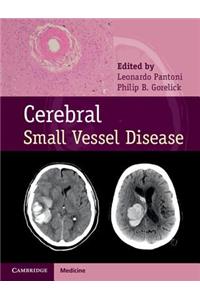 Cerebral Small Vessel Disease