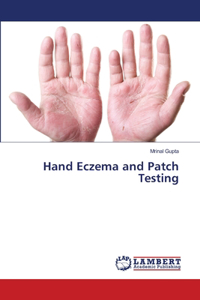 Hand Eczema and Patch Testing