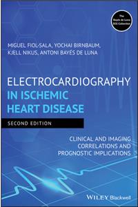 Electrocardiography in Ischemic Heart Disease