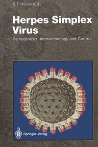 Herpes Simplex Virus