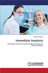 Immediate Implants