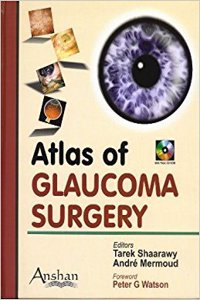 (PDF CD-ROM)) ATLAS OF GLAUCOMA SURGERY