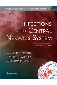 Infections of the Central Nervous System