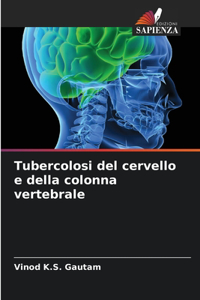 Tubercolosi del cervello e della colonna vertebrale