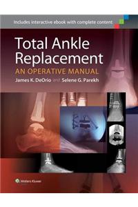 Total Ankle Replacement: An Operative Manual