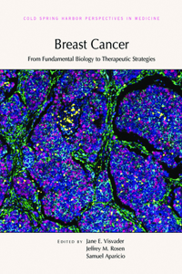 Breast Cancer: From Fundamental Biology to Therapeutic Strategies