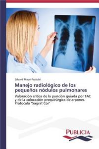 Manejo radiológico de los pequeños nódulos pulmonares