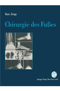 Chirurgie Des Fußes