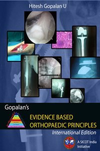 Gopalan's Evidence Based Orthopaedic Principles 2nd/rep 2023