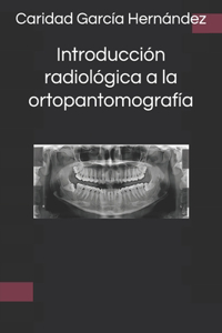 Introducción radiológica a la ortopantomografía