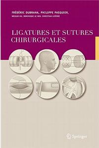 Ligatures Et Sutures Chirurgicales