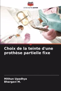 Choix de la teinte d'une prothèse partielle fixe