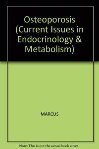 Osteoporosis (Current Issues in Endocrinology & Metabolism)