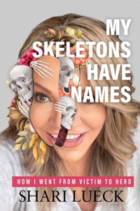 My Skeletons Have Names