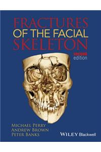 Fractures of the Facial Skeleton