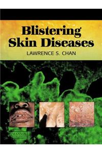 Blistering Skin Diseases