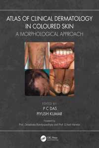 Atlas of Clinical Dermatology in Coloured Skin