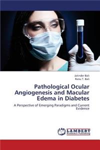 Pathological Ocular Angiogenesis and Macular Edema in Diabetes