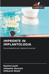 Impronte in Implantologia