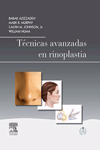 Tecnicas avanzadas en rinoplastia + StudentConsult en espanol