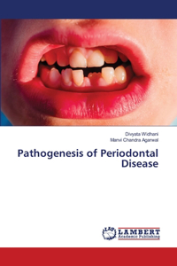 Pathogenesis of Periodontal Disease