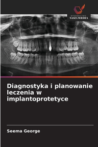 Diagnostyka i planowanie leczenia w implantoprotetyce