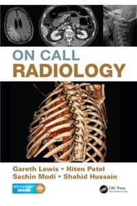 On Call Radiology
