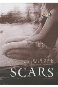 Scars