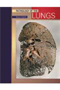 Pathology of Lung Tumors