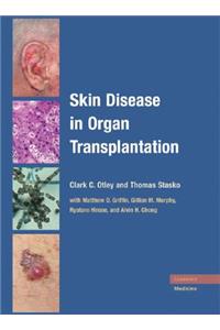 Skin Disease in Organ Transplantation