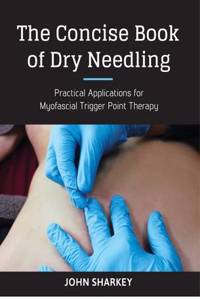 Concise Book of Dry Needling