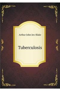 Tuberculosis