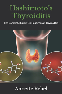 Hashimoto's Thyroiditis