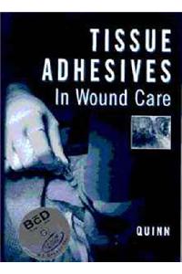 Tissue Adhesives in Wound Care