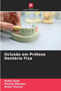 Oclusão em Prótese Dentária Fixa