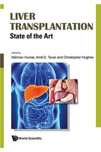 Liver Transplantation: State Of The Art