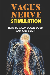 Vagus Nerve Stimulation