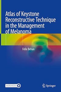 Atlas of Keystone Reconstructive Technique in Melanoma Management