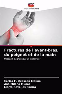 Fractures de l'avant-bras, du poignet et de la main