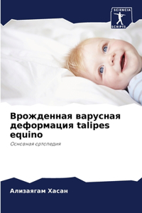 Врожденная варусная деформация talipes equino