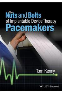 The Nuts and Bolts of Implantable Device Therapy