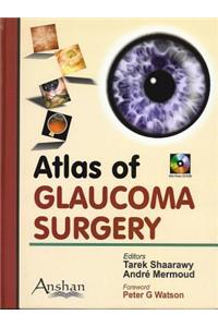 Atlas of Glaucoma Surgery