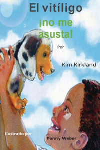 vitiligo no me asusta