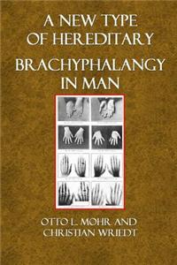 A New Type of Hereditary Brachyphalangy in Man