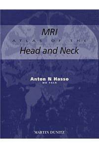 MRI Atlas of the Head and Neck