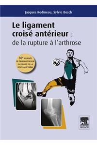 Le Ligament Croisé Antérieur: de la Rupture À l'Arthrose