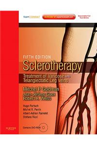 Sclerotherapy