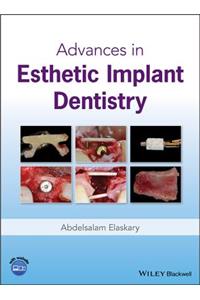 Advances in Esthetic Implant Dentistry