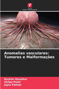 Anomalias vasculares